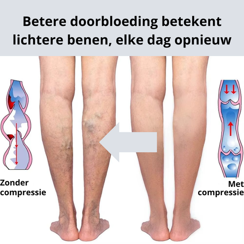 Compressie kousen voor betere doorbloeding, Steunkousen tegen zware benen, Comfortabele compressie sokken, Open teen compressiekousen, Compressie kousen tegen vermoeide benen, Spatader kousen met ondersteuning, Compressiekousen voor dagelijkse steun, Steunkousen voor werk en reizen, Compressiekousen voor zwelling in de enkels, Comfort compressiekousen voor dames, Compressiekousen voor heren, Kousen voor betere bloedcirculatie, Steunkousen bij langdurig staan, Compressiekousen voor tijdens zwangerschap, Open